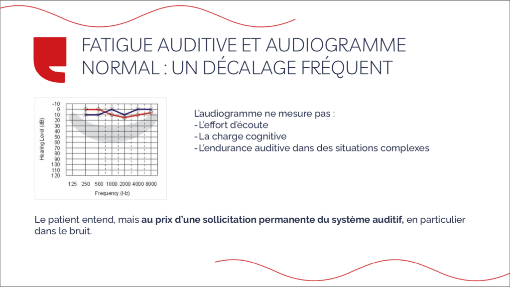 Fatigue auditive et audiogramme normal : un décalage fréquent